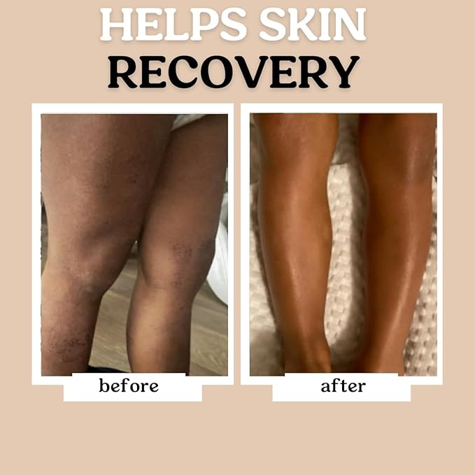 Roe Wellness Baby Hair, Scalp & Body Oil Unscented | Massage, Soothe, & Hydrates Irritated Skin | All Natural Non-Greasy Hydrating | Moisturize Full Body