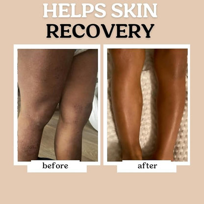 Roe Wellness Baby Hair, Scalp & Body Oil Unscented | Massage, Soothe, & Hydrates Irritated Skin | All Natural Non-Greasy Hydrating | Moisturize Full Body