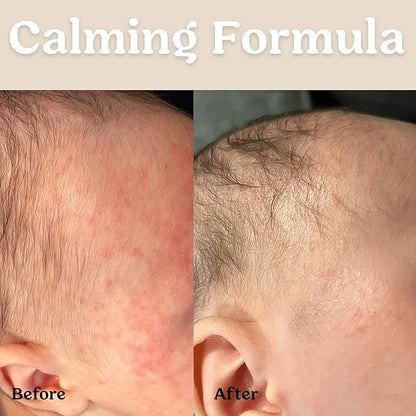 Roe Wellness Baby Hair, Scalp & Body Oil Unscented | Massage, Soothe, & Hydrates Irritated Skin | All Natural Non-Greasy Hydrating | Moisturize Full Body