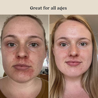 Roe Wellness- Baby Serum Hydrating Skincare EWG Verified Non-Toxic Ingredients Probiotic Protection | Hydrate, Soothe, Safe For All Skin Babies, Infants, Toddlers & Kids (Power Serum)