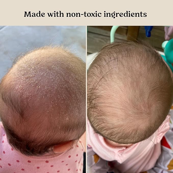 Roe Wellness Baby Hair, Scalp & Body Oil Unscented | Massage, Soothe, & Hydrates Irritated Skin | All Natural Non-Greasy Hydrating | Moisturize Full Body