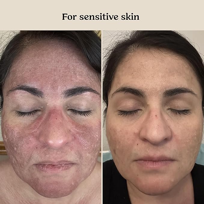 Roe Wellness- Baby Cream Lotion Ointment EWG Verified Non-Toxic Ingredients | Full Body Biome Barrier | Dry Skin, Itch Relief, Moisturizing, All Over Ointment | Toddlers & Kids